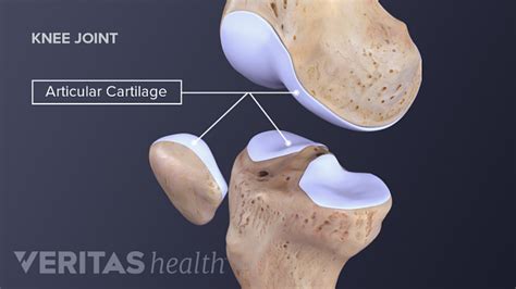 Knee Cartilage Repair, Regeneration, and Replacement | Sports-health