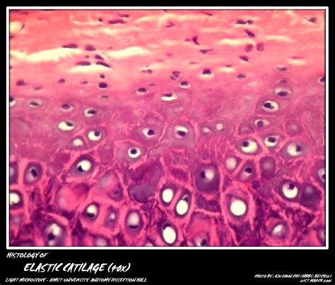 Histology: Cartilage - My Aimst University Lifestyle Blog