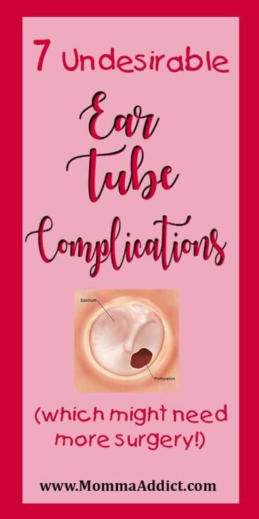 7 Undesirable Ear Tube Complications (which may require more surgery!) - Momma Addict