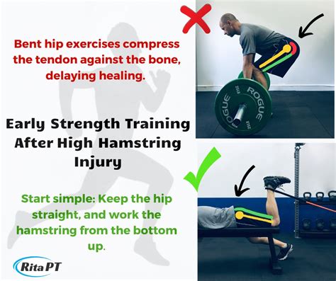 Top 10+ high hamstring tendinopathy exercises The best - Bút Chì Xanh