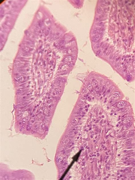 Non Ciliated Simple Columnar Epithelium | Simple, Tissue, Rectangular