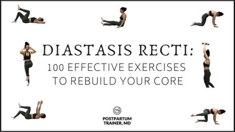 100 Effective Diastasis Recti Exercises (The Ultimate Workout Plan) - Postpartum Trainer, MD