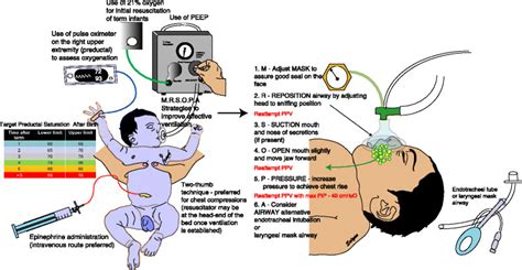 Neonatal Resus Chart