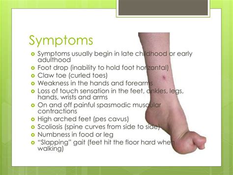 PPT - Charcot-Marie-Tooth Disease PowerPoint Presentation - ID:3991494