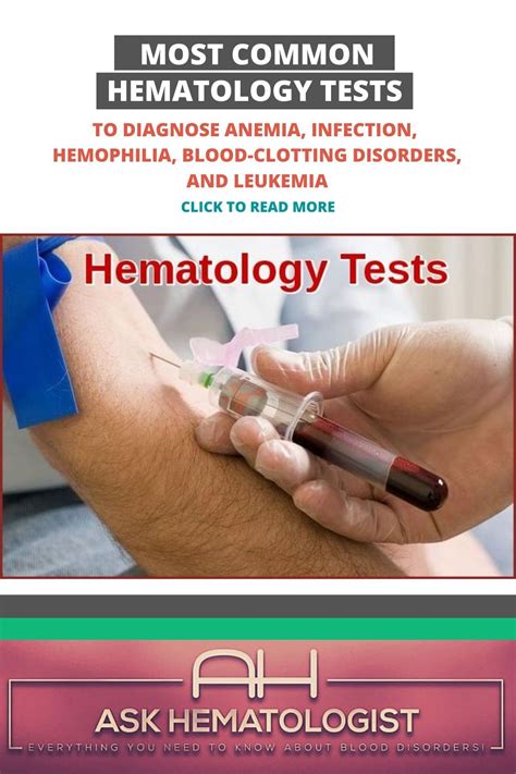 Common hematology tests – Artofit