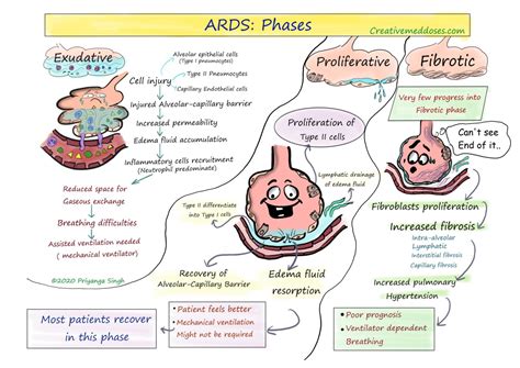 Acute Respiratory Distress Syndrome (ARDS) - Creative Med Doses