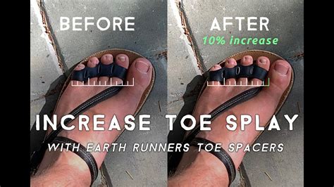 Runners Toe Won't Go Away at Vanessa Pepper blog