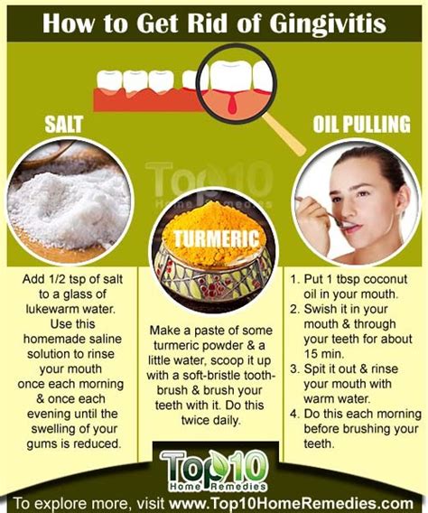 How to Get Rid of Gingivitis | Top 10 Home Remedies