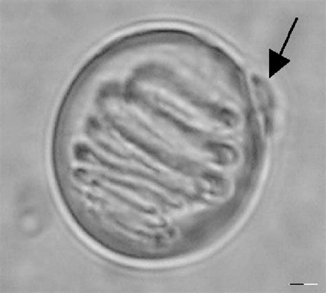 Nematocysts Under Microscope