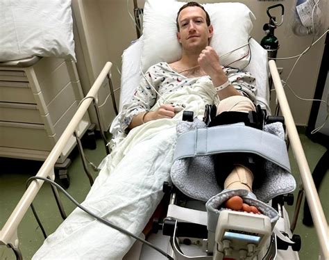 Mark Zuckerberg pumps fist from hospital bed after MMS injury