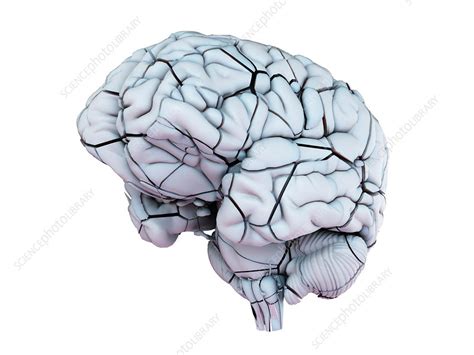 Broken human brain, illustration - Stock Image - F029/4287 - Science Photo Library