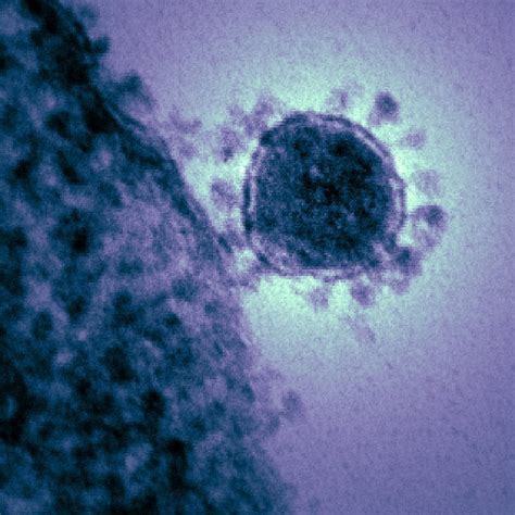 First person-to-person transmission of coronavirus in the US