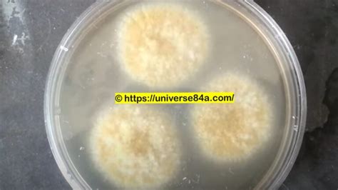 Aspergillus flavus: Introduction, Morphology, Pathogenicity, Lab Diagnosis