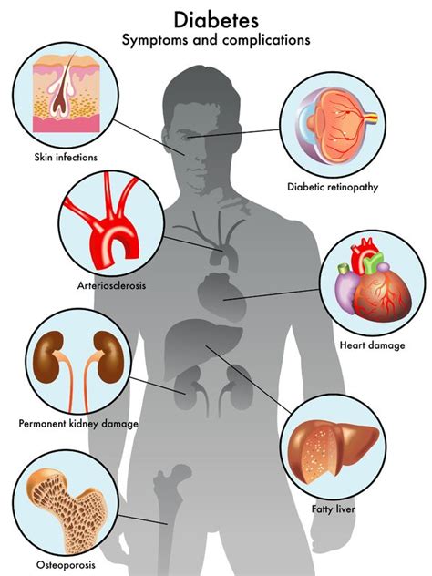 Diabetic Vascular Disease - Treatment in Israel | D.R.A Medical