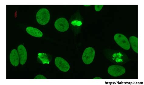 Anti-centromere antibodies