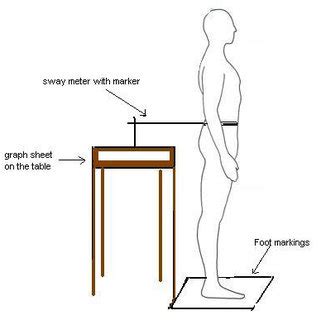 (PDF) Measurement of Postural Sway with a Sway Meter-an Analysis