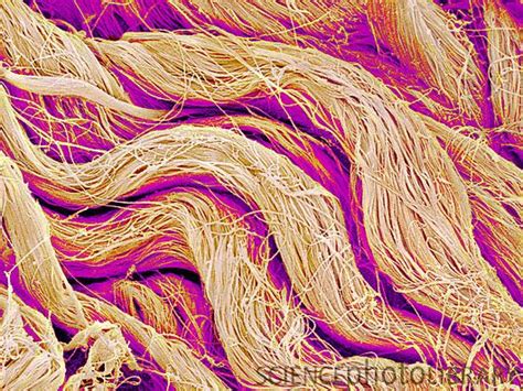 Collagen fibres. Coloured scanning electron micrograph (SEM) of collagen from the dermis of the ...