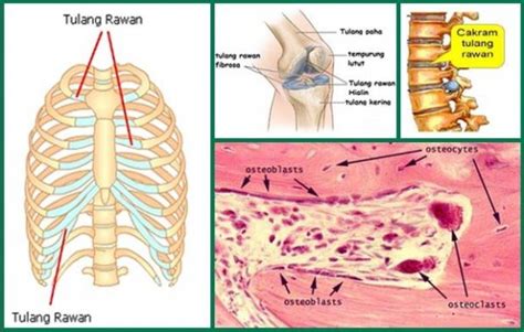 Tulang Rawan Brain - Riset