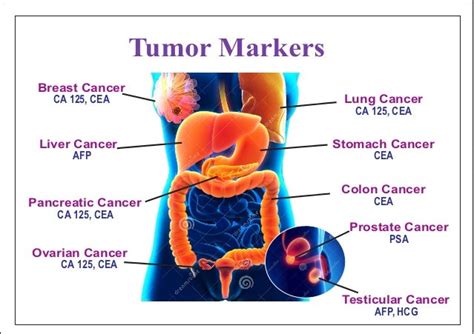 Tumor Markers