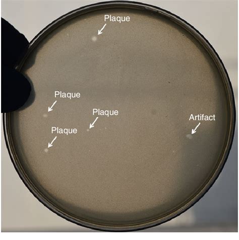 A representative plate of plaque assay for bacteriophages isolation... | Download Scientific Diagram