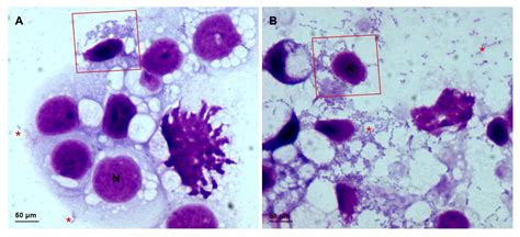 Rickettsia Rickettsii Microscope