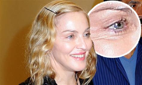 Madonna plastic surgery: Experts take closer look | Daily Mail Online