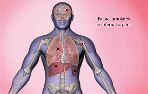 Health Condition : Symptoms, Causes, Treatment and More