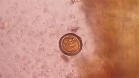 Egg of tapeworm or Taenia under the Microscope of saline preparation - YouTube