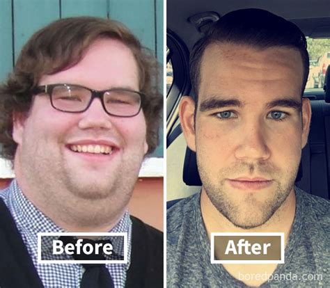 128 Surprising Photos of Face Fat Loss Before and After Weight Loss | Bored Panda