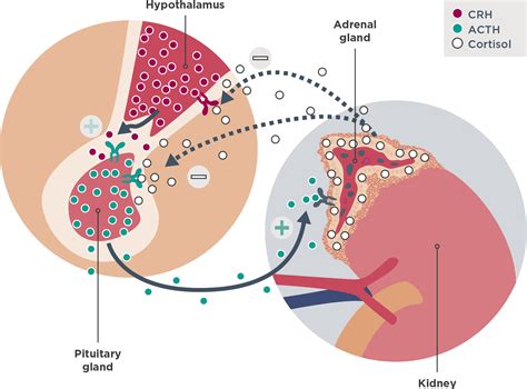 Cortisol Regulation and Endogenous Hypercortisolism | Korlym ...