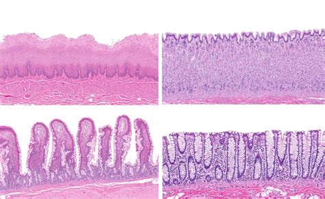 Growing Intestinal Epithelial Cells May Lead to Personalized IBD Therapies