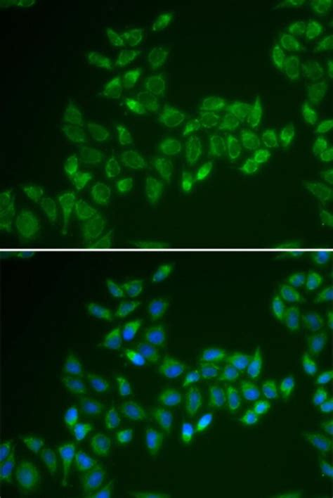 CAT1 Polyclonal Antibody, Invitrogen 100 μL; Unconjugated:Antibodies ...