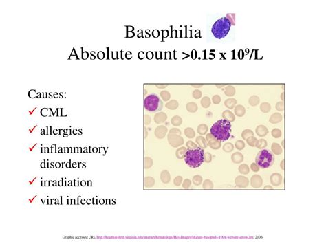 PPT - Morphologic and Distributive Leukocyte Disorders PowerPoint ...