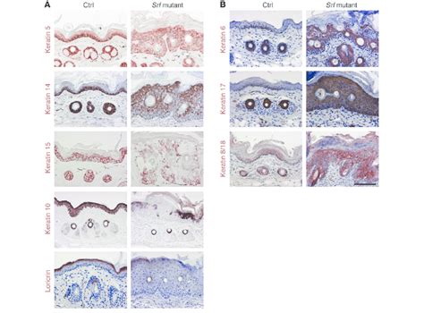 Keratinocyte differentiation is impaired in Srf mutant epidermis. (A... | Download Scientific ...