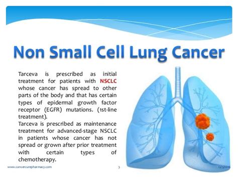 Tratamientos de cáncer de pulmón no de células pequeñas por etapa ...