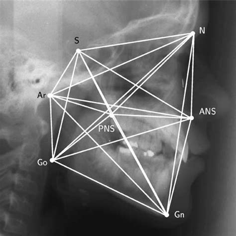 Midsaggital section of a rat skull showing the 8 landmarks used: Basion... | Download Scientific ...