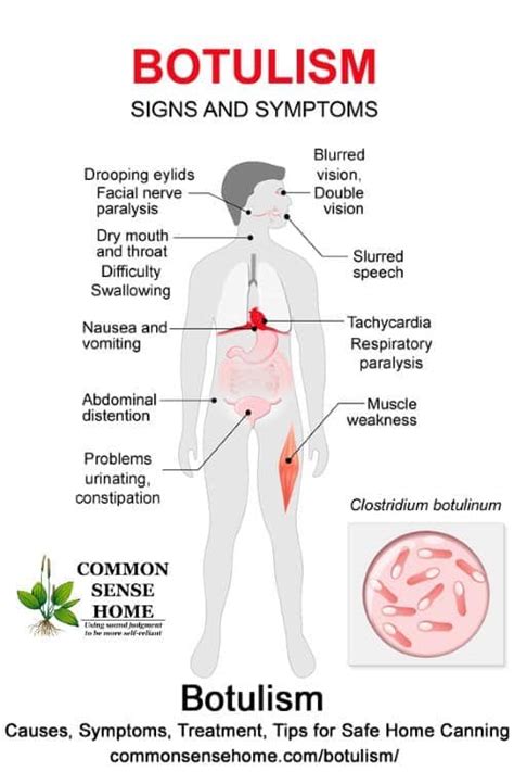 bOtulISM 🛎The toxin of... - البورد العراقي للصيدلة السريرية