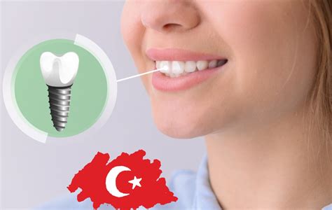 Dental Implants in Turkey Packages | Dentatur