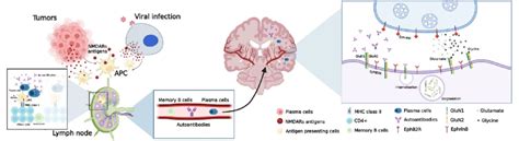 Speculative etiology of anti-NMDA receptor encephalitis associated with... | Download Scientific ...