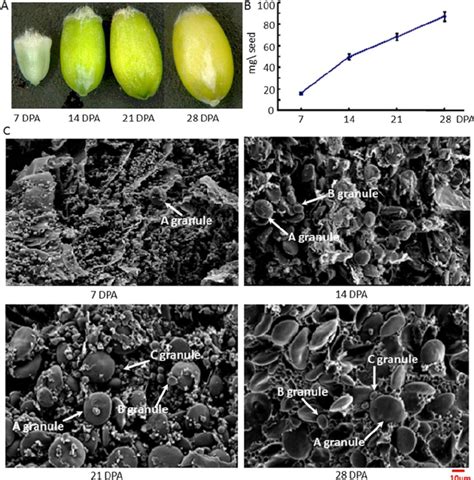 Grain development during four stages after anthesis in bread wheat ...