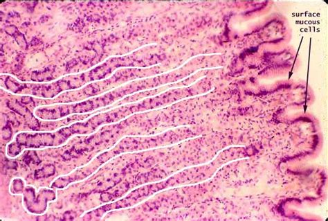 Histology as SIU