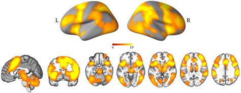 Brain activation maps for general response inhibition on whole | Download Scientific Diagram