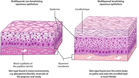 Fig. 47.7, [Microstructure of nonkeratinizing and keratinizing skin ...