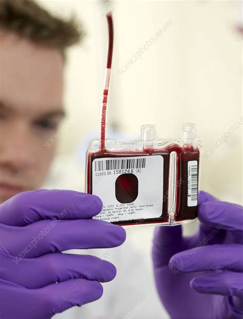 Umbilical cord blood stem cells - Stock Image - M532/0876 - Science ...