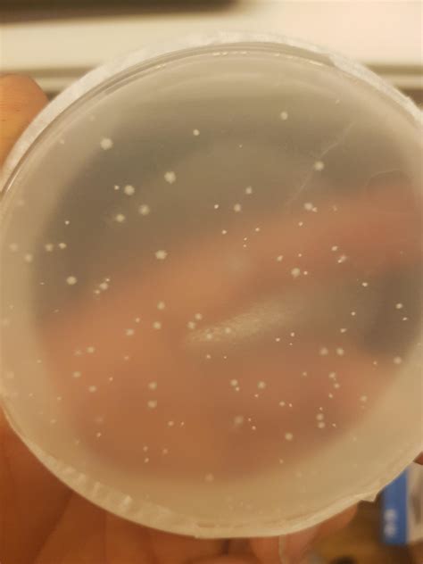 First time with agar, is this contamination? The specs are not growing. : shrooms