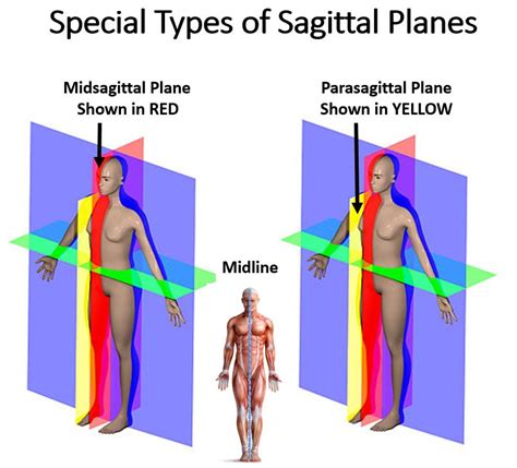 Parasagittal Plane Only