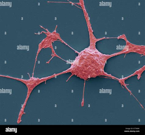 Neurone. Scanning electron micrograph (SEM) of a PC12 neurone in Stock Photo, Royalty Free Image ...