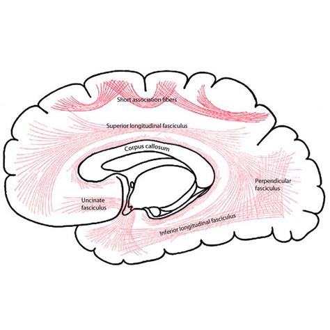 Subcortical U-fibres | Radiology Reference Article | Radiopaedia.org ...