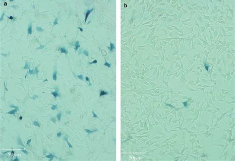 FR901228 enhanced LacZ gene expression. ( a ) LacZ expression was ...