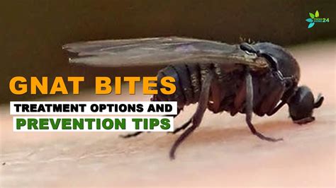 How to Treat Gnat Bites | Treatment Options and Prevention Tips - YouTube